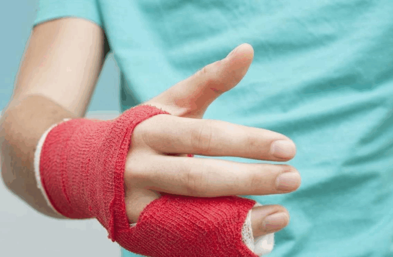 На Рівненщині підлітки постраждали внаслідок вибуху батарейки та петарди