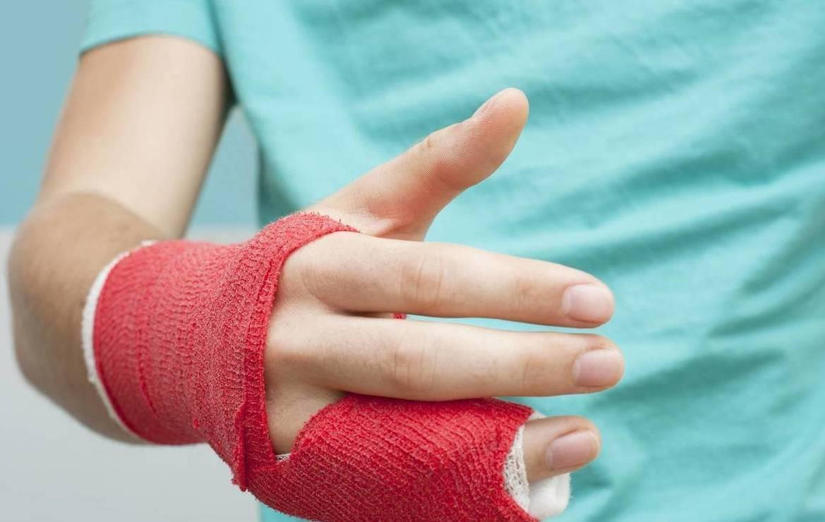 Новини України - На Рівненщині підлітки постраждали внаслідок вибуху батарейки та петарди