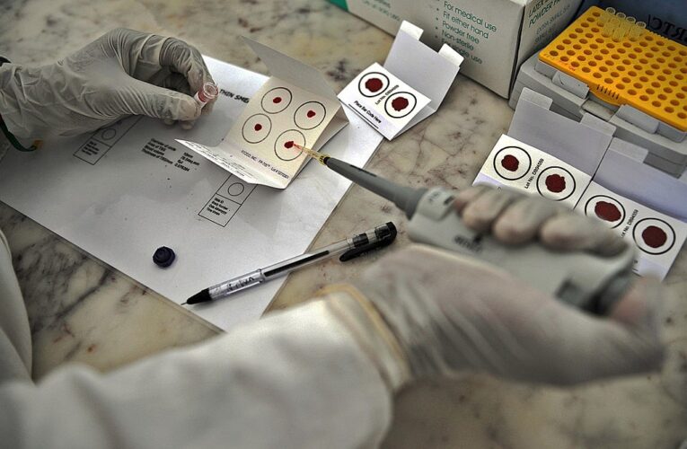 На Сумщині від тропічної малярії помер чоловік