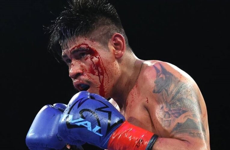 Наваррет пролив світло на суперечливий момент зупинки його бою з Суаресом