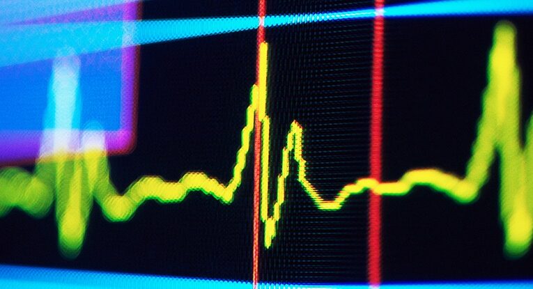 Ритм у пульсі людини може сигналізувати про майбутнє когнітивне погіршення