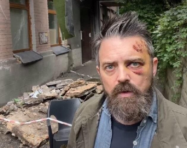 У Києві на американця впав балкон – КМВА