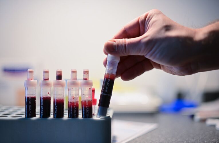 Відомо, скільки випадків ВІЛ-інфекції зафіксували в Україні з початку року