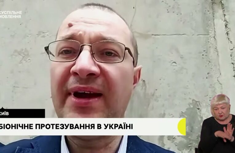 Біонічне протезування. Гостьова студія з Віталієм Музиченко, гендиректором Фонду.