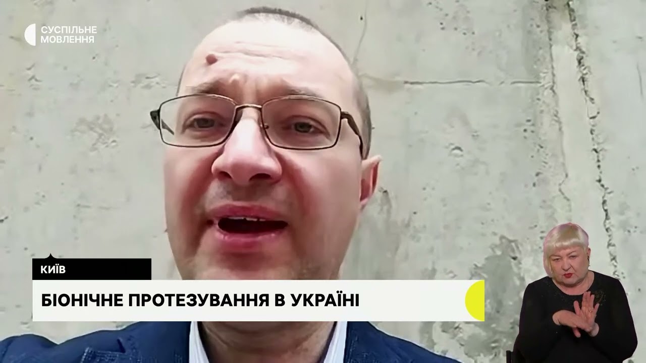 Біонічне протезування. Гостьова студія з Віталієм Музиченко, гендиректором Фонду.