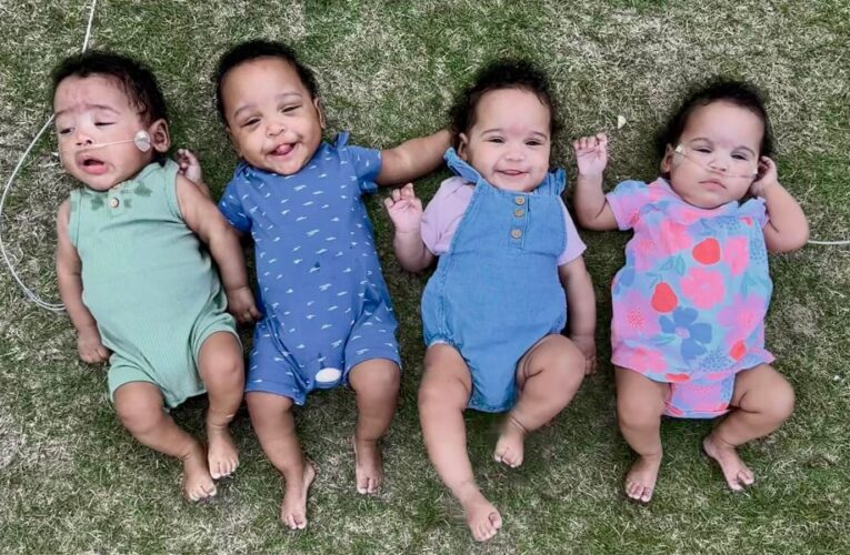 В США народилась найпередчасніша четвірня в історії