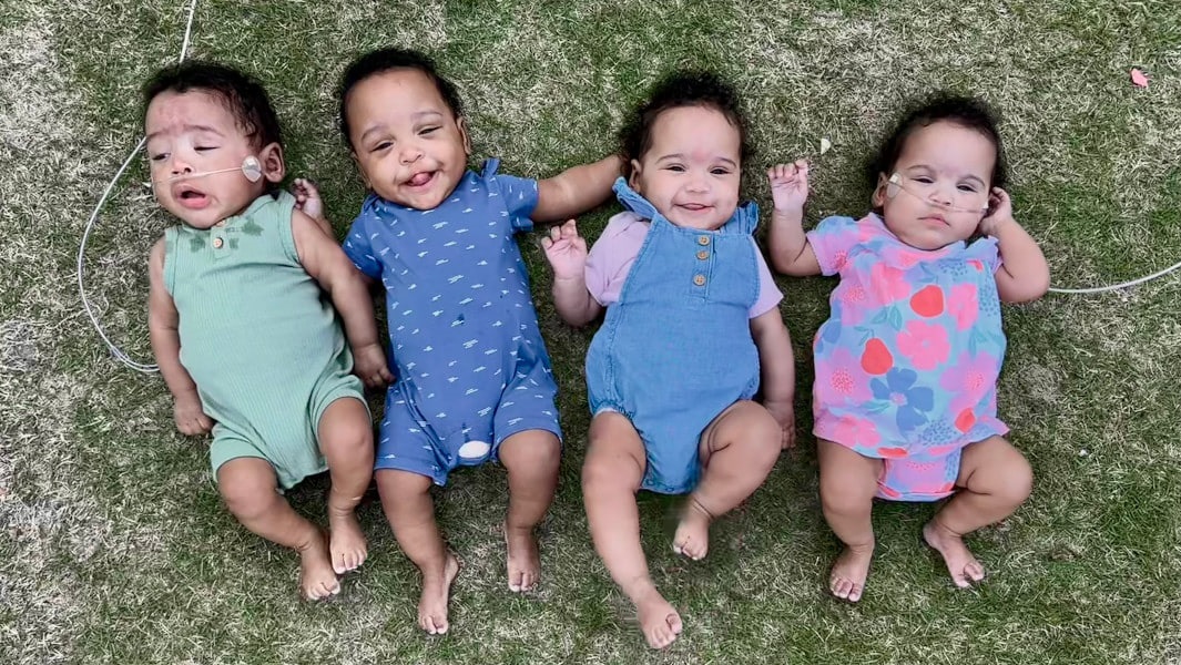 Новини світу - В США народилась найпередчасніша четвірня в історії