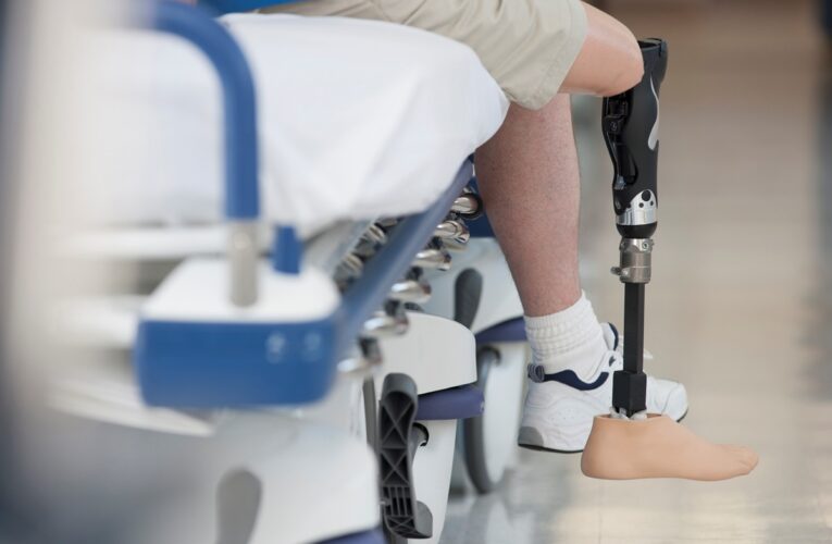 Саудівська Аравія запустила п’ятий етап протезування українців