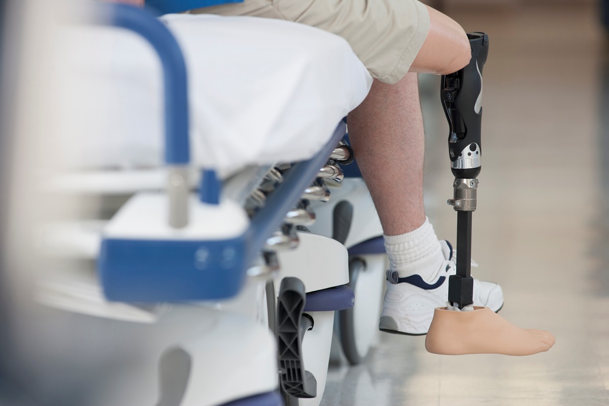 Новини України - Саудівська Аравія запустила п’ятий етап протезування українців