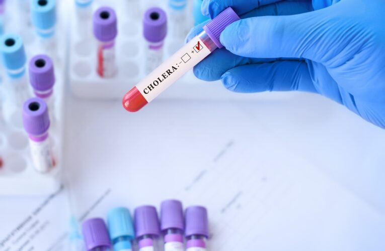 У Польщі перший випадок холери за шість років