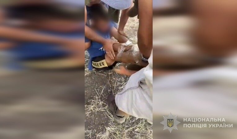 На Одещині група людей зв’язала і катувала підлітка