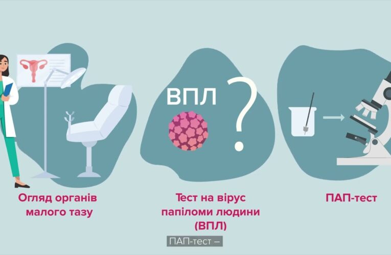 Турбота про жіноче здоров’я починається з профілактики