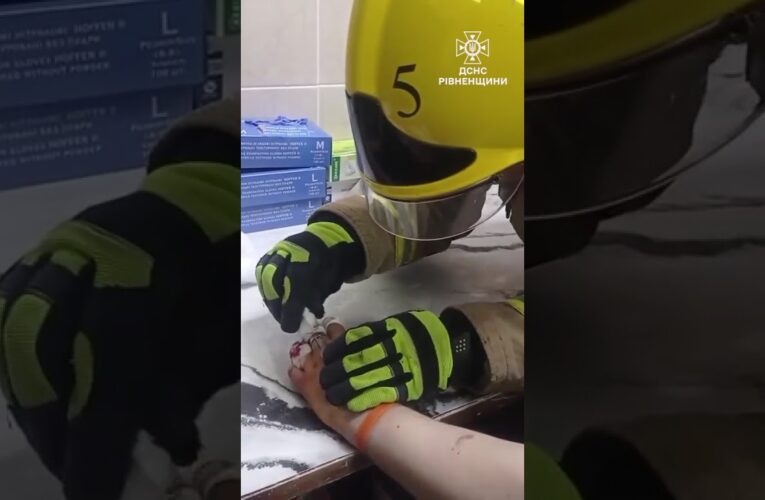 Хірургічна точність: на Рівненщині рятувальники вивільнити палець підлітка із металевої «пастки»