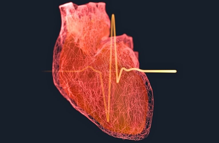 Вчені назвали вік, при якому ризик інфаркту у чоловіків різко зростає