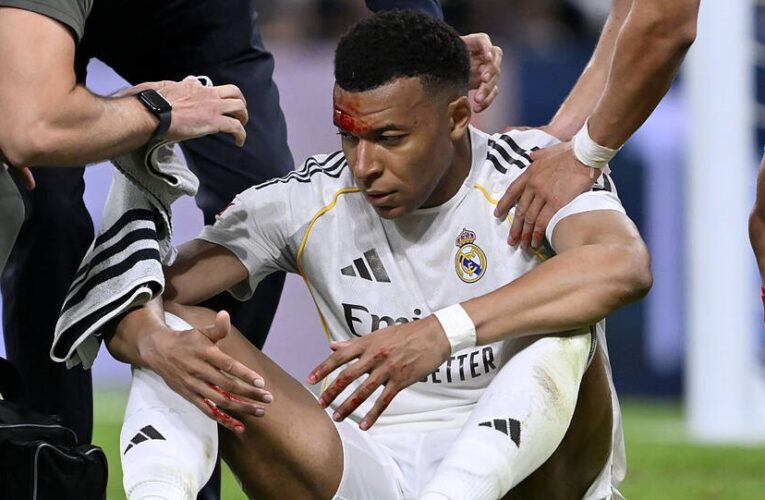 Розтин не перешкода: Мбаппе очікують у матчі Ліги чемпіонів