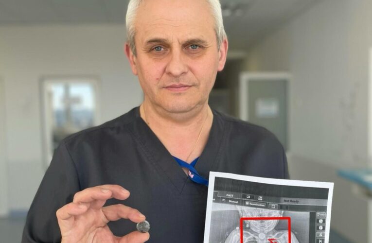 У Львові врятували дитину, яка місяцями жила з батарейкою у стравоході