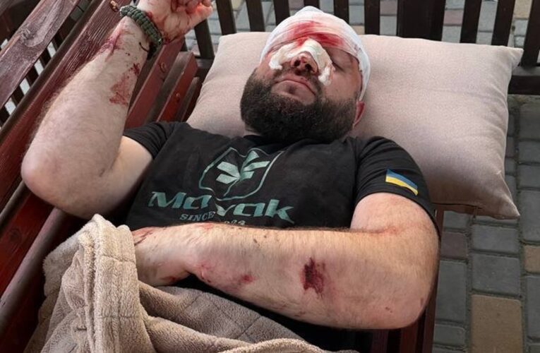 На Одещині жорстоко побили військового за зауваження про російську музику